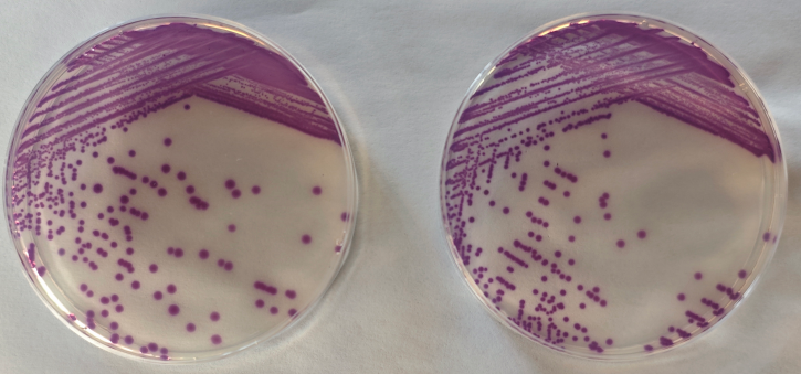 沙門檢測新助手—沙門氏+顯色培養(yǎng)基