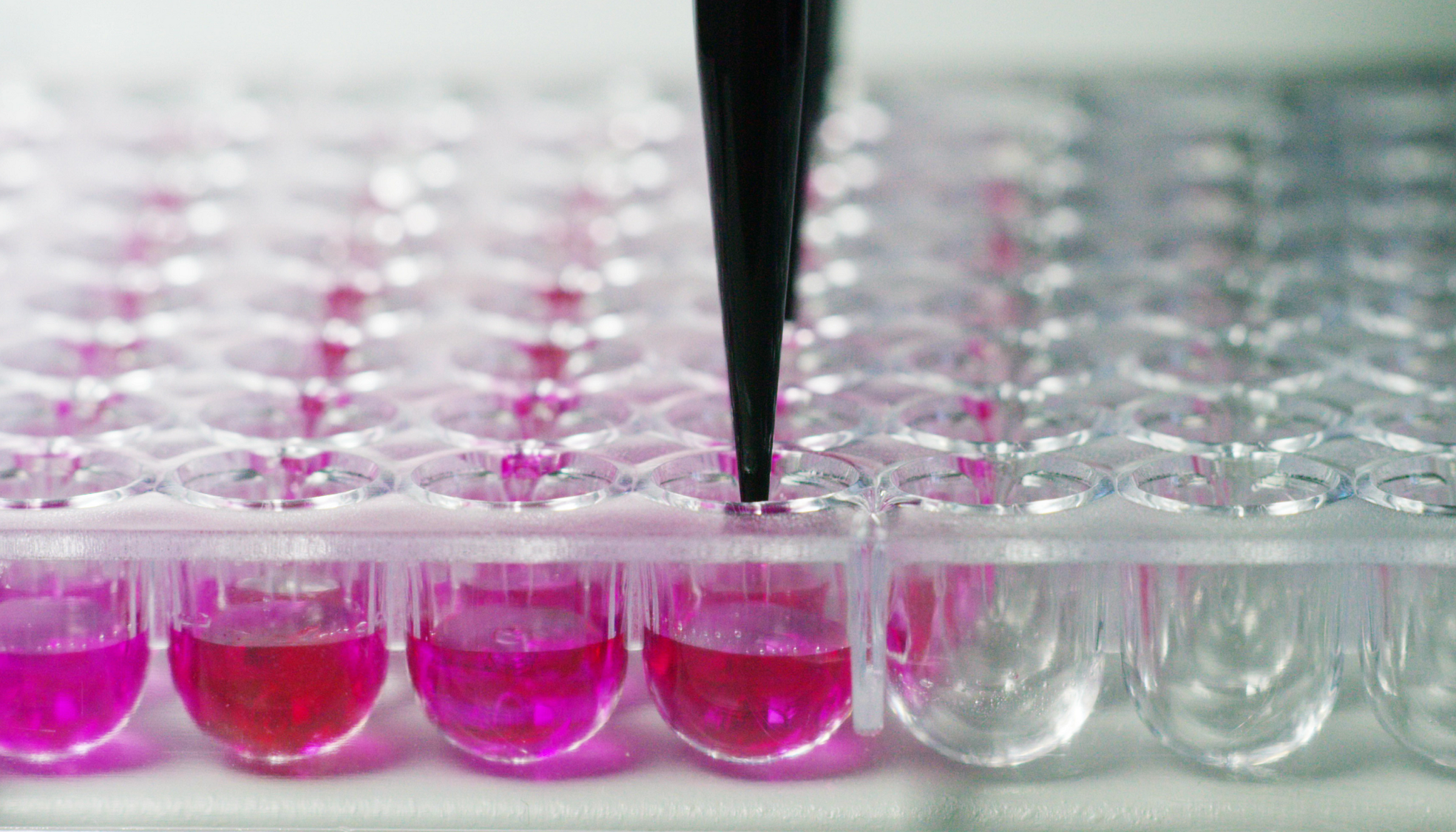 福氏志賀氏菌“靛基質(zhì)試驗”的結果討論