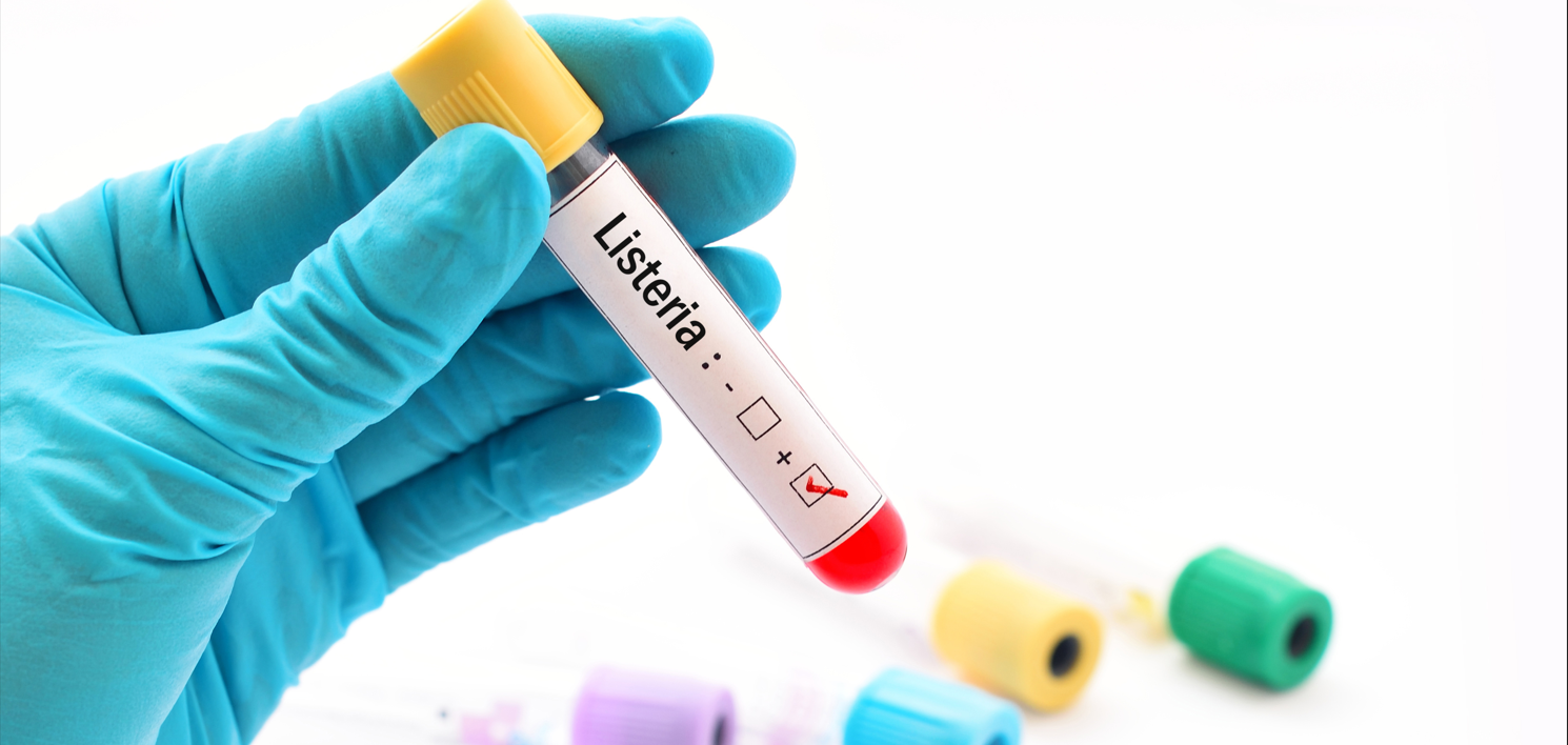 GB4789.30-2025單核細胞增生李斯特氏菌標(biāo)準(zhǔn)變化
